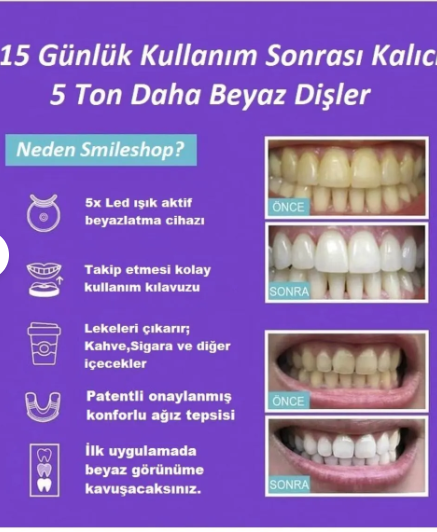 LED Işıklı Diş Beyazlatma Kiti – Profesyonel Ev Tipi Diş Beyazlatma Seti