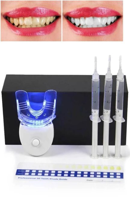 LED Işıklı Diş Beyazlatma Kiti – Profesyonel Ev Tipi Diş Beyazlatma Seti