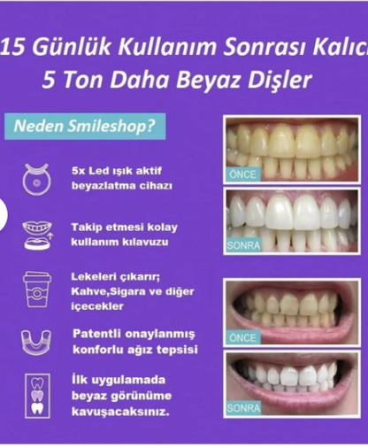 LED Işıklı Diş Beyazlatma Kiti – Profesyonel Ev Tipi Diş Beyazlatma Seti